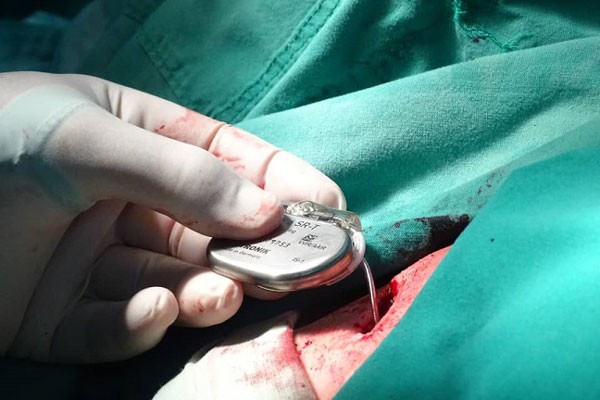 Cuba contra el bloqueo