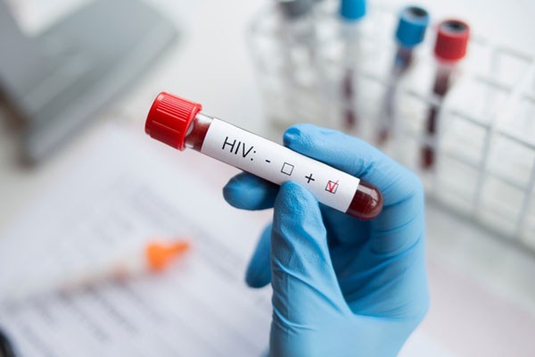 Prevalencia del Sida en Angola