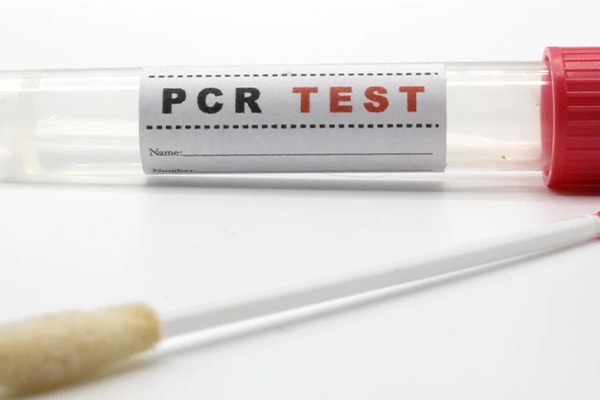 ¿Por qué no se realiza un tamizaje masivo para detectar la presencia de dengue y chikungunya?