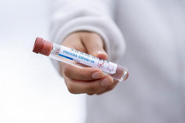 Prueba Test Covid19 positiv