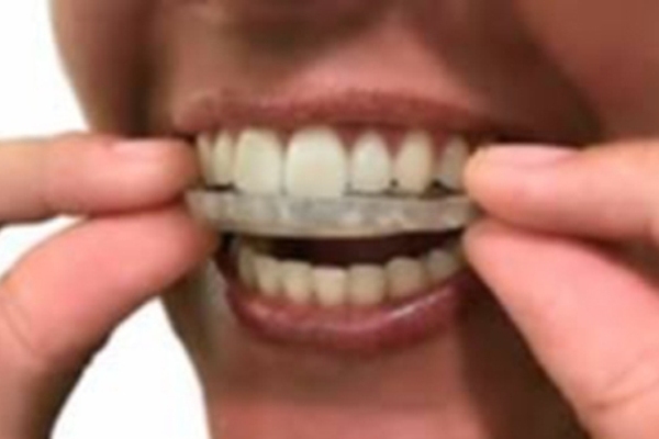 cirugia ortognatica 02