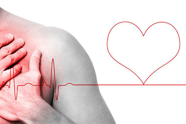 arritmias cardiacas 1